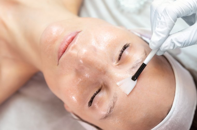 Fruchtsäurepeeling für glatte und strahlende Haut