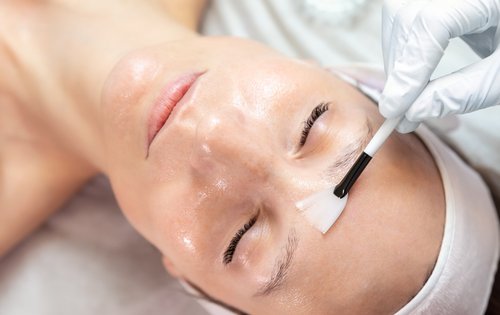 Fruchtsäurepeeling für glatte und strahlende Haut