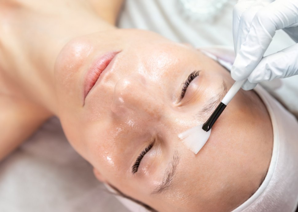 Fruchtsäurepeeling für glatte und strahlende Haut