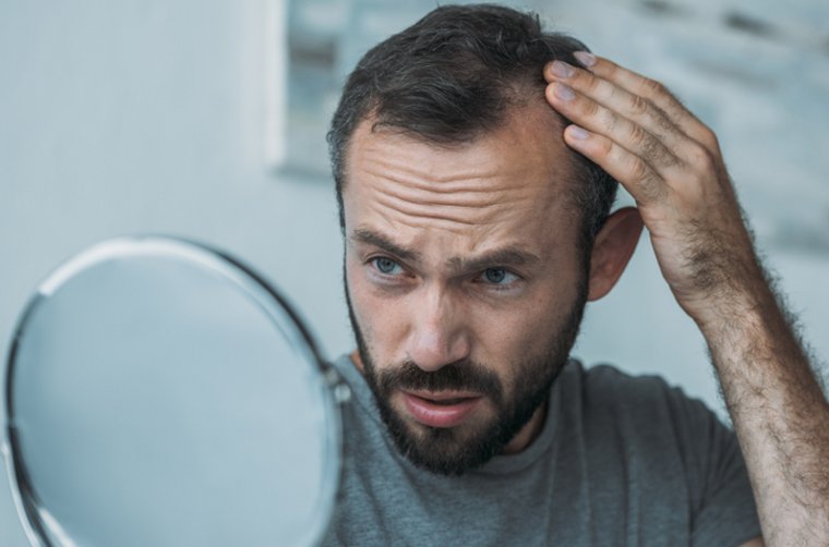 Haarausfall stoppen – mit diesen Tipps klappt’s wirklich