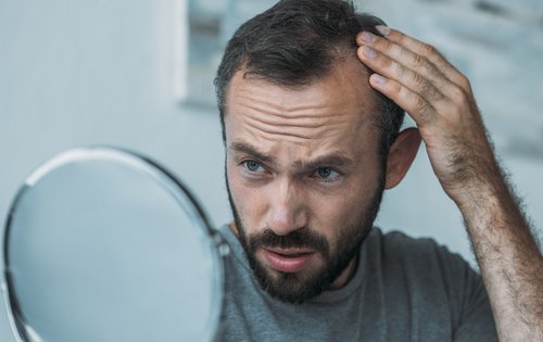 Haarausfall stoppen – mit diesen Tipps klappt’s wirklich