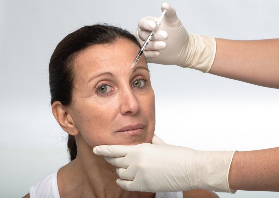 Falten mit Botox behandeln