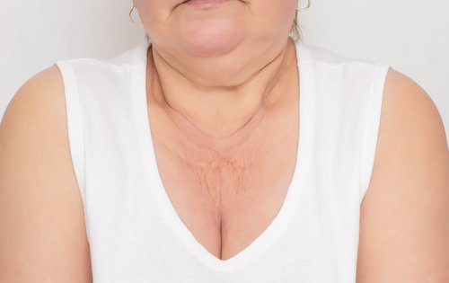 Dekolleté: Der vergessene Anti-Aging-Bereich
