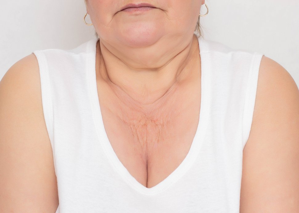 Dekolleté: Der vergessene Anti-Aging-Bereich