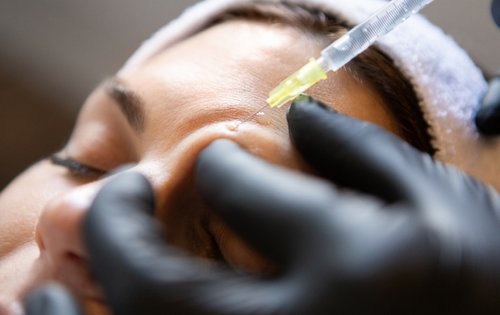 Falten lügen nicht – aber Sie können sie mildern